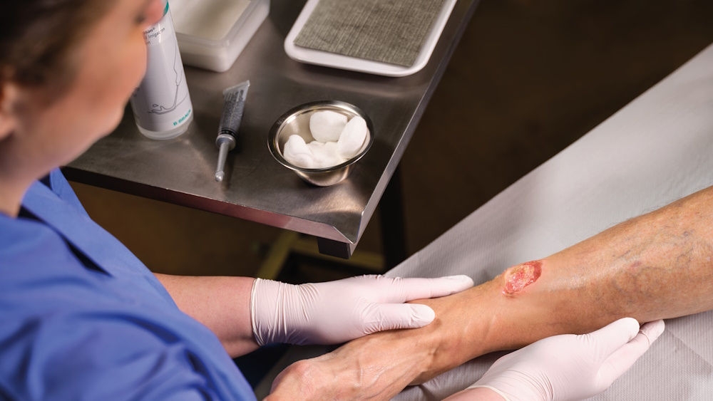 healthcare professional examining a leg wound on an elderly patient. Medical supplies including wound management solutions, are visible on a medical tray, indicating a wound care or treatment setting.